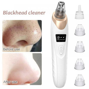 Electric Blackhead Remover, Vacuum Acne Cleaner, Black Spots Removal Device
